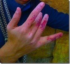 contactosangriento-cabecodor